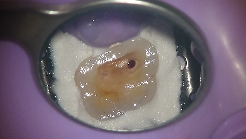 隔壁＆ラバーダム